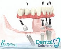 Slider image (3) Dental Solutions Los Algodones